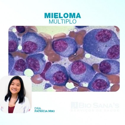 Mieloma Múltiplo
