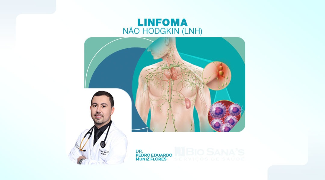 Linfomas Não-Hodgkin 