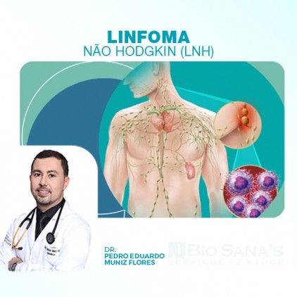 Linfomas Não-Hodgkin 