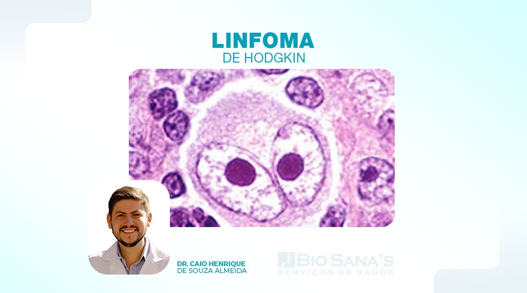 Linfoma de Hodgkin