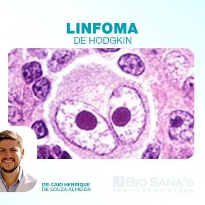 Linfoma de Hodgkin