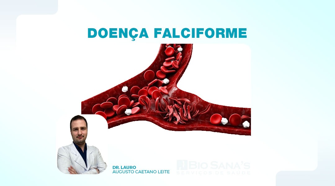 Doença Falciforme