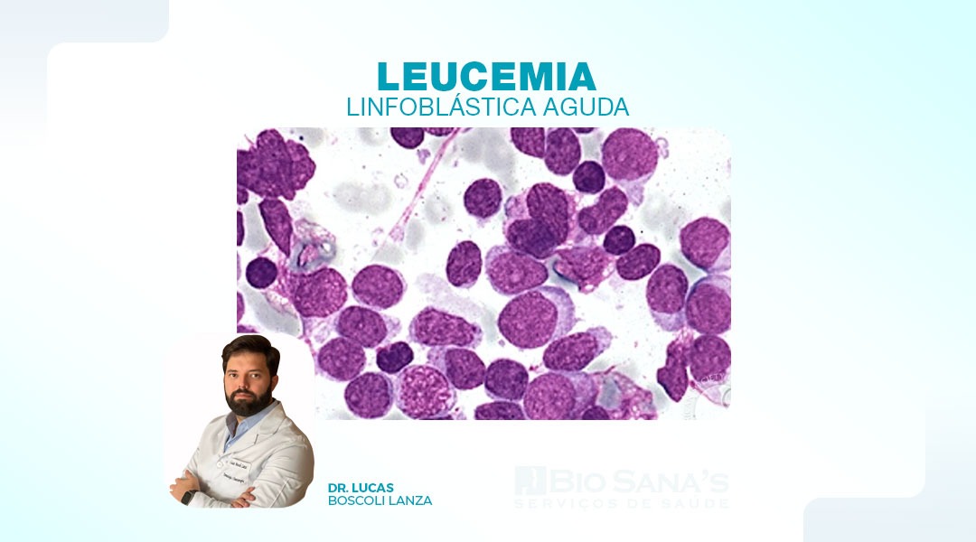 Leucemia Linfoblástica Aguda