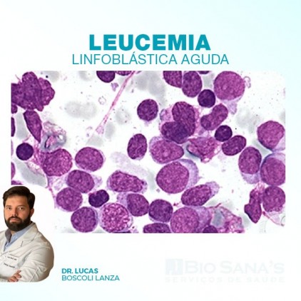 Leucemia Linfoblástica Aguda