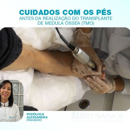 Cuidados com os pés antes da realização do Transplante de Medula Óssea(TMO)