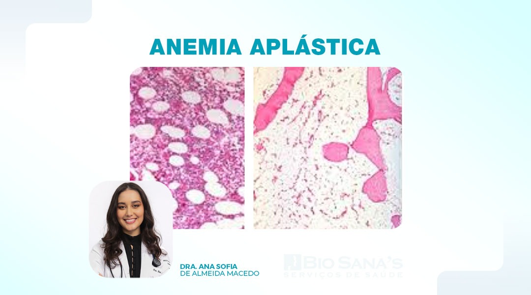 Anemia aplástica (AA) 