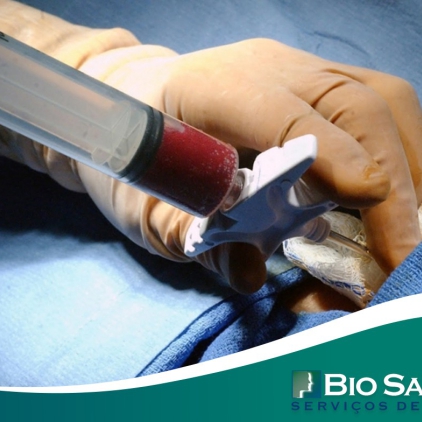 Quais as etapas do Transplante de Medula Óssea (TMO)?