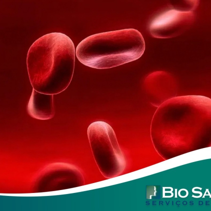 O que é o Transplante de Medula Óssea (TMO) ou Transplante de Células Tronco Hematopoiéticas (TCTH)? 