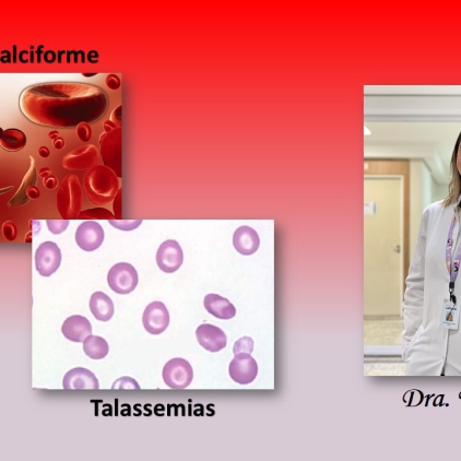 Na semana onde se comemora o Dia Nacional das Hemoglobinopatias, a Dra. Thábata Cristina Paradas Moreira da Silva, oncopediatra da Equipe de Transplante de Medula Óssea da Bio Sana's e Leforte DASA, descreve os principais diagnósticos e seus tratamentos