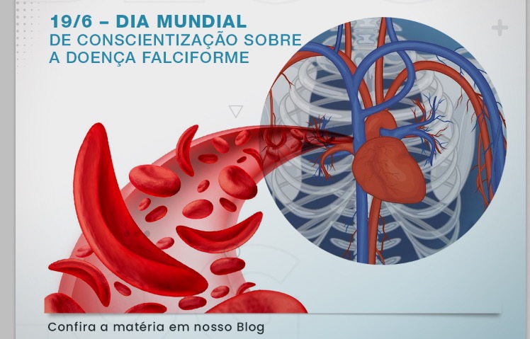 Transplante de Medula Óssea