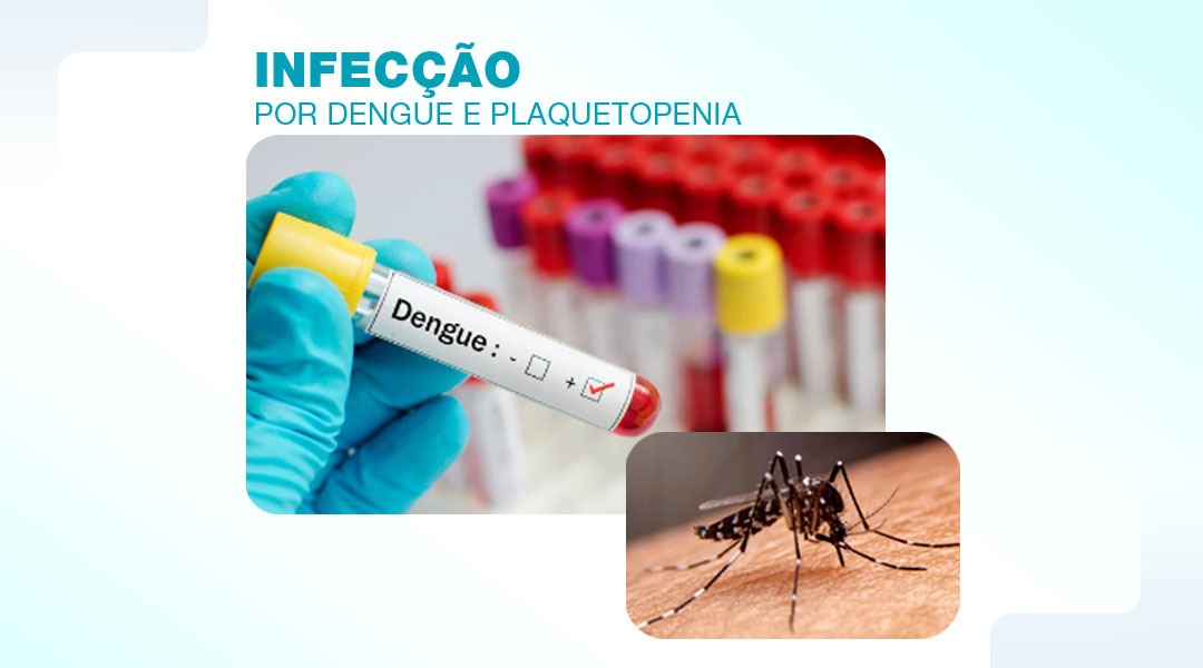 Infecção por dengue e plaquetopenia 