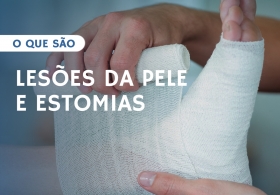 TRATAMENTO AVANÇADO DE LESÕES DA PELE E ESTOMIAS