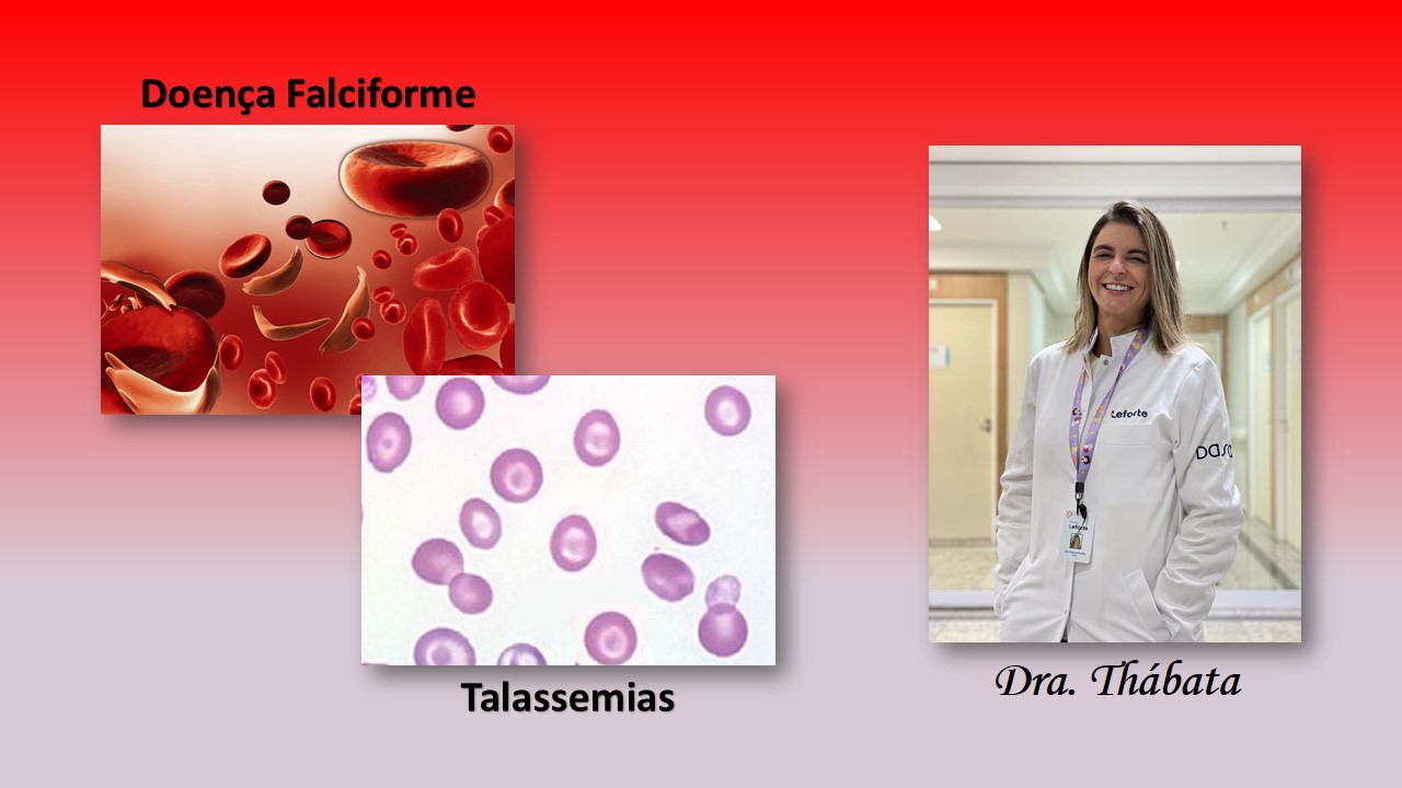 Na semana onde se comemora o Dia Nacional das Hemoglobinopatias, a Dra. Thábata Cristina Paradas Moreira da Silva, oncopediatra da Equipe de Transplante de Medula Óssea da Bio Sana's e Leforte DASA, descreve os principais diagnósticos e seus tratamentos