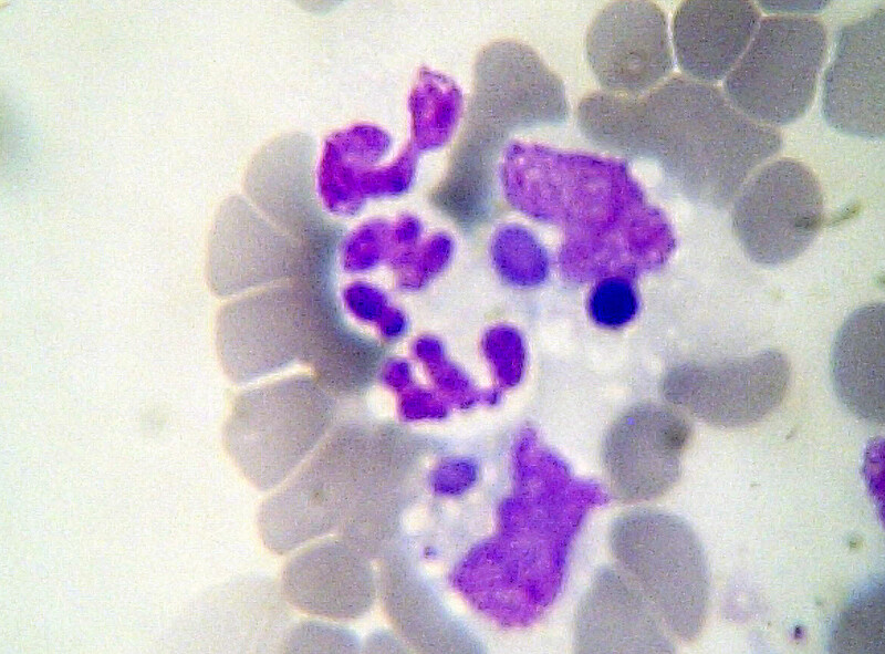 Leucopenia