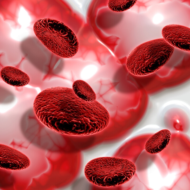 Hiperferritinemia / Hemocromatose