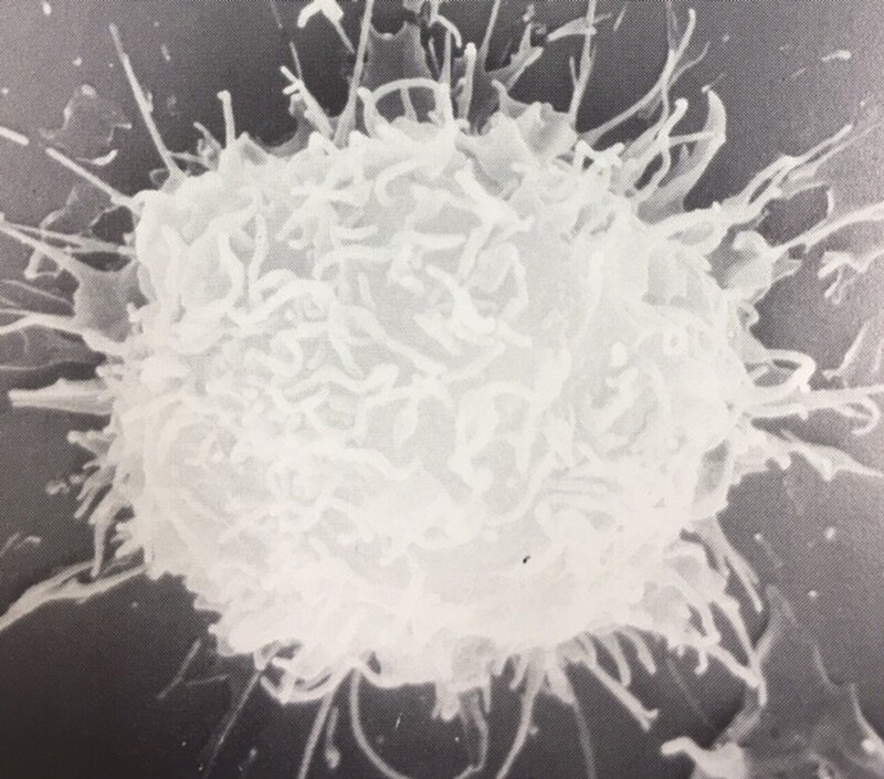 Tricoleucemia