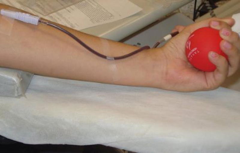 Transplante de Medula Óssea Autólogo